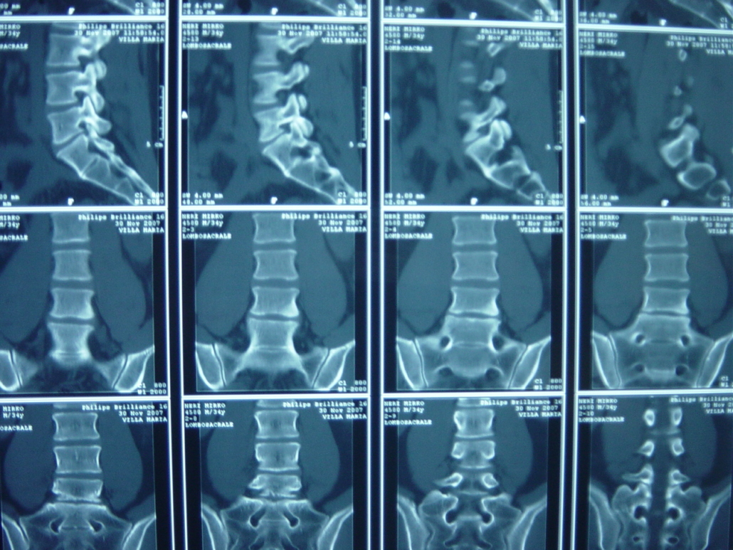 Il Mal Di Schiena Quali Sono I Principali Strumenti Per Una Diagnosi Corretta Per Addetti Ai Lavori